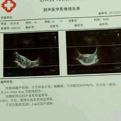 怀孕染头发对胎儿有影响吗