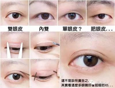 老贴双眼皮贴会怎么样