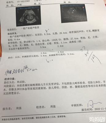 怀孕两周胎儿有多大