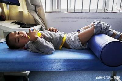 新生儿手脚发紫图片