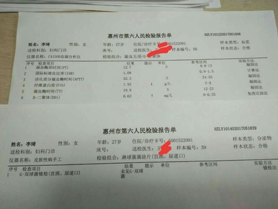 怀孕染色体怎么检查