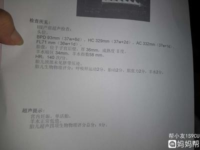 一般羊水多少正常