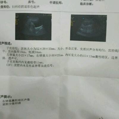 怀孕卵巢囊肿怎么办