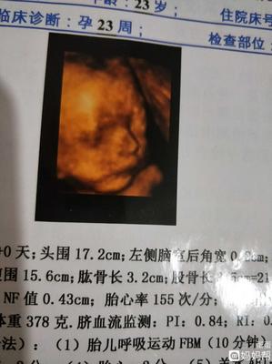四维中头围多少是男孩