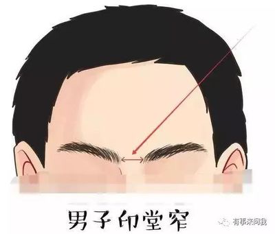 额头两侧发黑是怎么回事