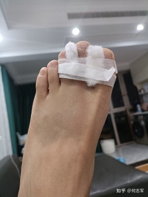 脚面浮肿是怎么回事