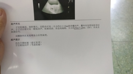 怎么去医院检查怀孕