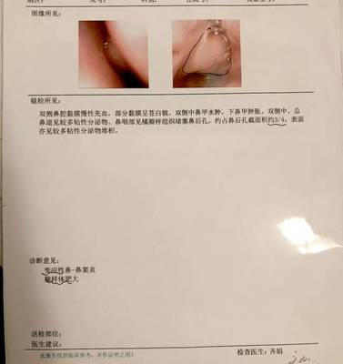 三岁宝宝扁桃体肥大怎么办