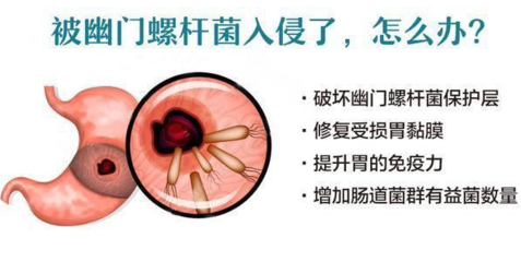 螺杆菌怎么治疗