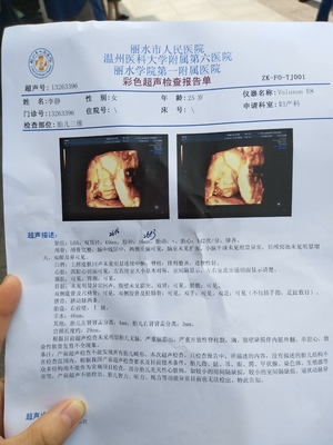 胎儿肾盂分离是什么意思