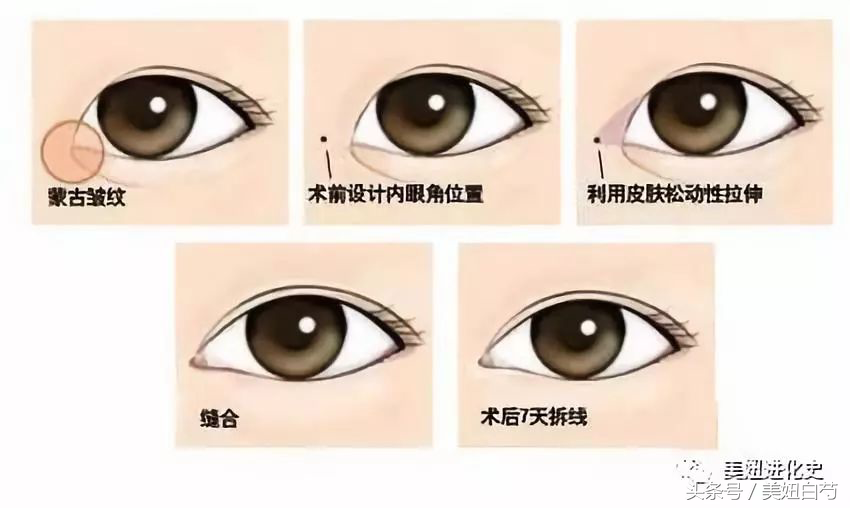 那些眼睛不适合开眼角