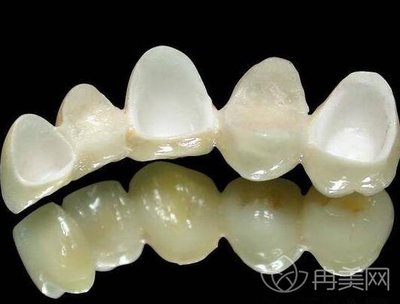 贵金属烤瓷牙的危害