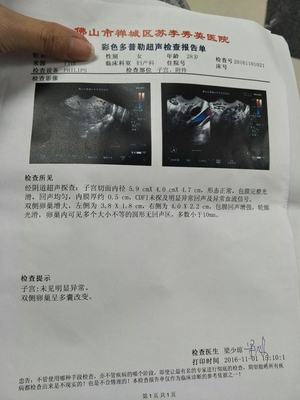 双侧卵巢多囊会怀孕吗