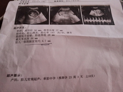 什么检查能查出怀孕