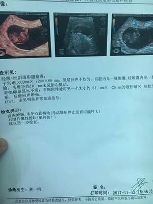 怀孕12周见红了有事吗