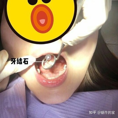 经常感觉恶心想吐是怎么回事