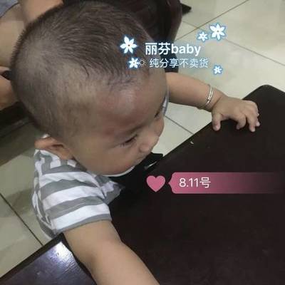 宝宝头右侧摔了个大包