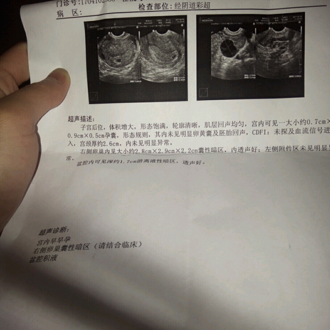 怀孕两个月能做吗