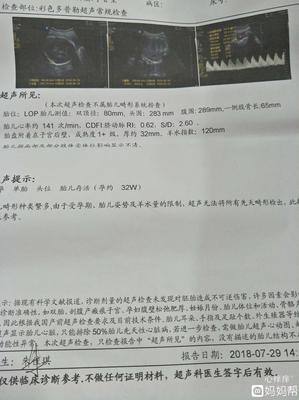 胎儿偏小吃什么长胎