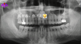 牙齿应该直立吗