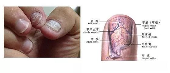 手指甲出现横纹是怎么回事