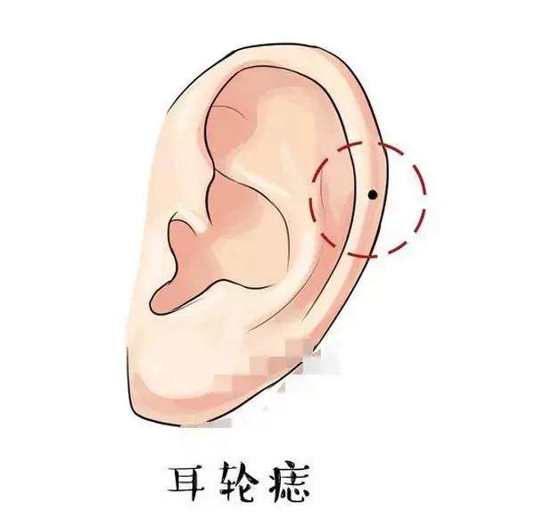 耳朵痣的位置与命运图