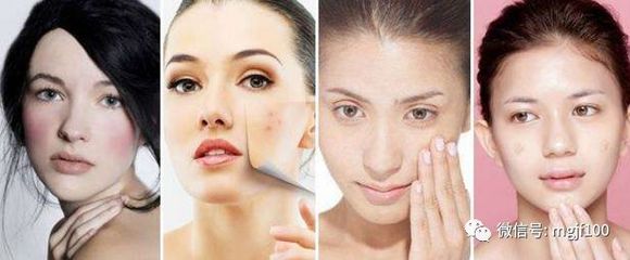 夏天脸痒怎么办?生理盐水对我的脸有什么影响?