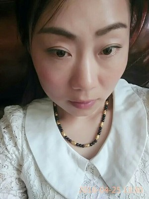 内双算双眼皮基因吗