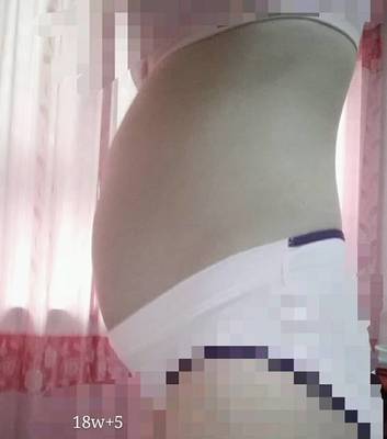 怀孕后壁
