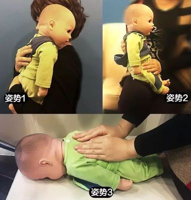 宝宝有痰怎么拍背