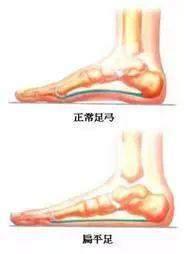 脚底板中间疼是怎么回事