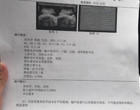 小排畸有宝宝照片吗