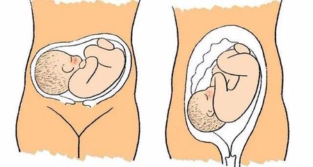 怀孕多少周胎儿能存活