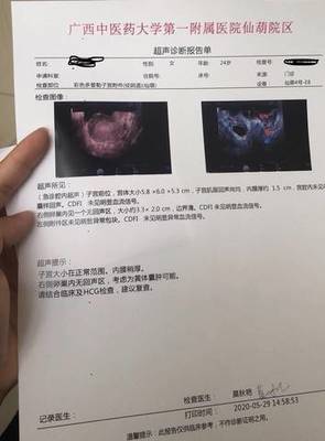 过几天能查出是否怀孕