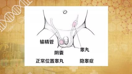 男宝宝睾丸正常图