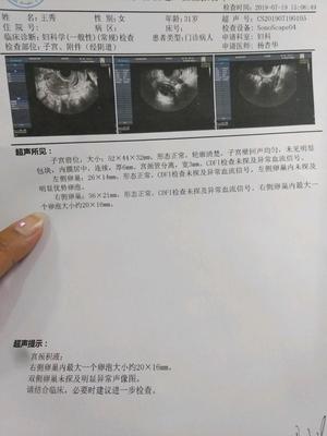 卵泡最晚能多少天排卵
