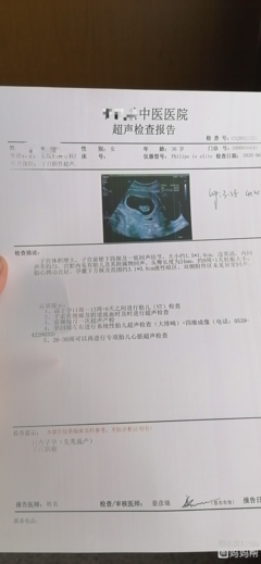 胎儿发育小