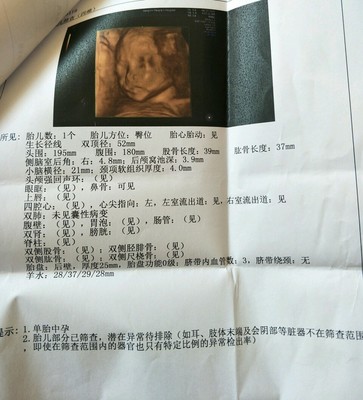 怎么看怀孕没