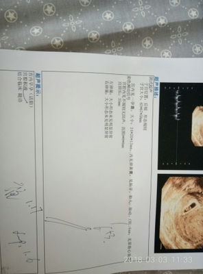 吃孕酮对胎儿有影响吗