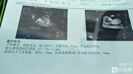 胎儿后期一周长多少斤
