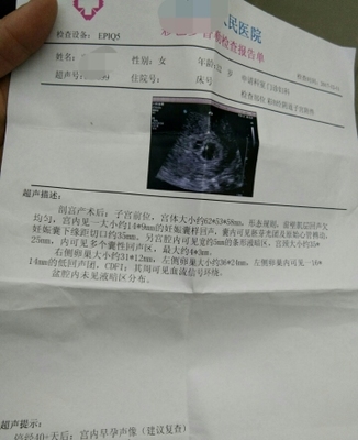 怀孕四十天需要做什么检查