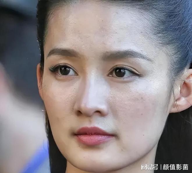 脸上长满小痘痘