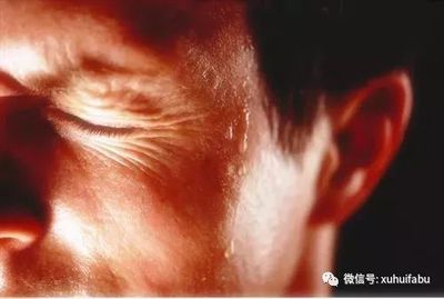 下半身盗汗是怎么回事