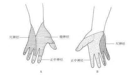 右手发麻是怎么回事