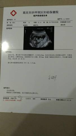 怀孕三个月胎儿多少斤