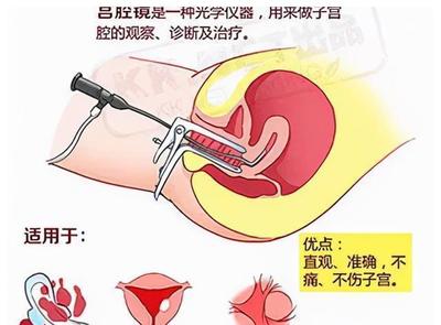 宫腔镜取环后多久可以怀孕