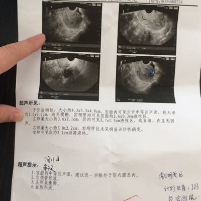 宫腔镜做完多久可以怀孕