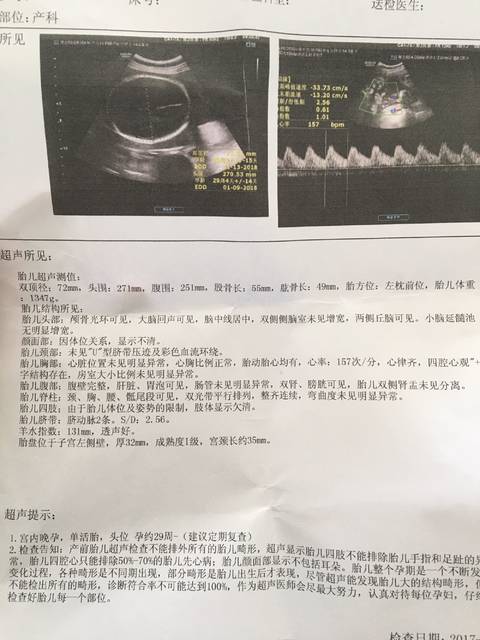 胎儿22周图片