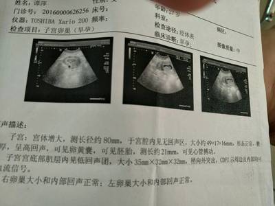 怎么测试男女宝宝最准