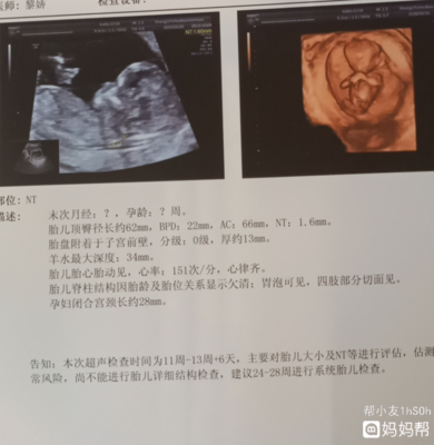 五个多月的胎儿有多大